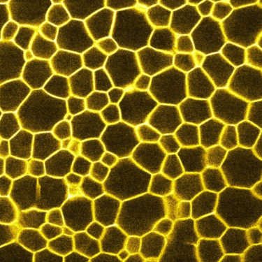 Confocal micrograph of particle-stabilized emulsion after squeezing.